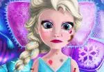 Elsa Ledové království zraněný'