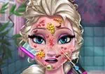 Elsa metge de la pell